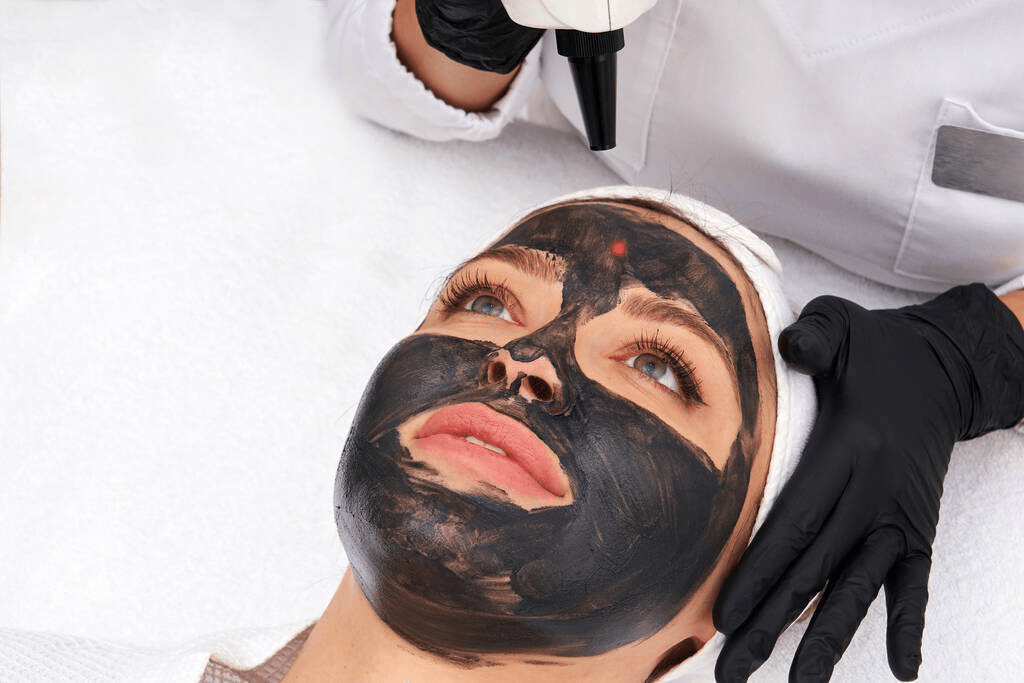 Photo carbon peel